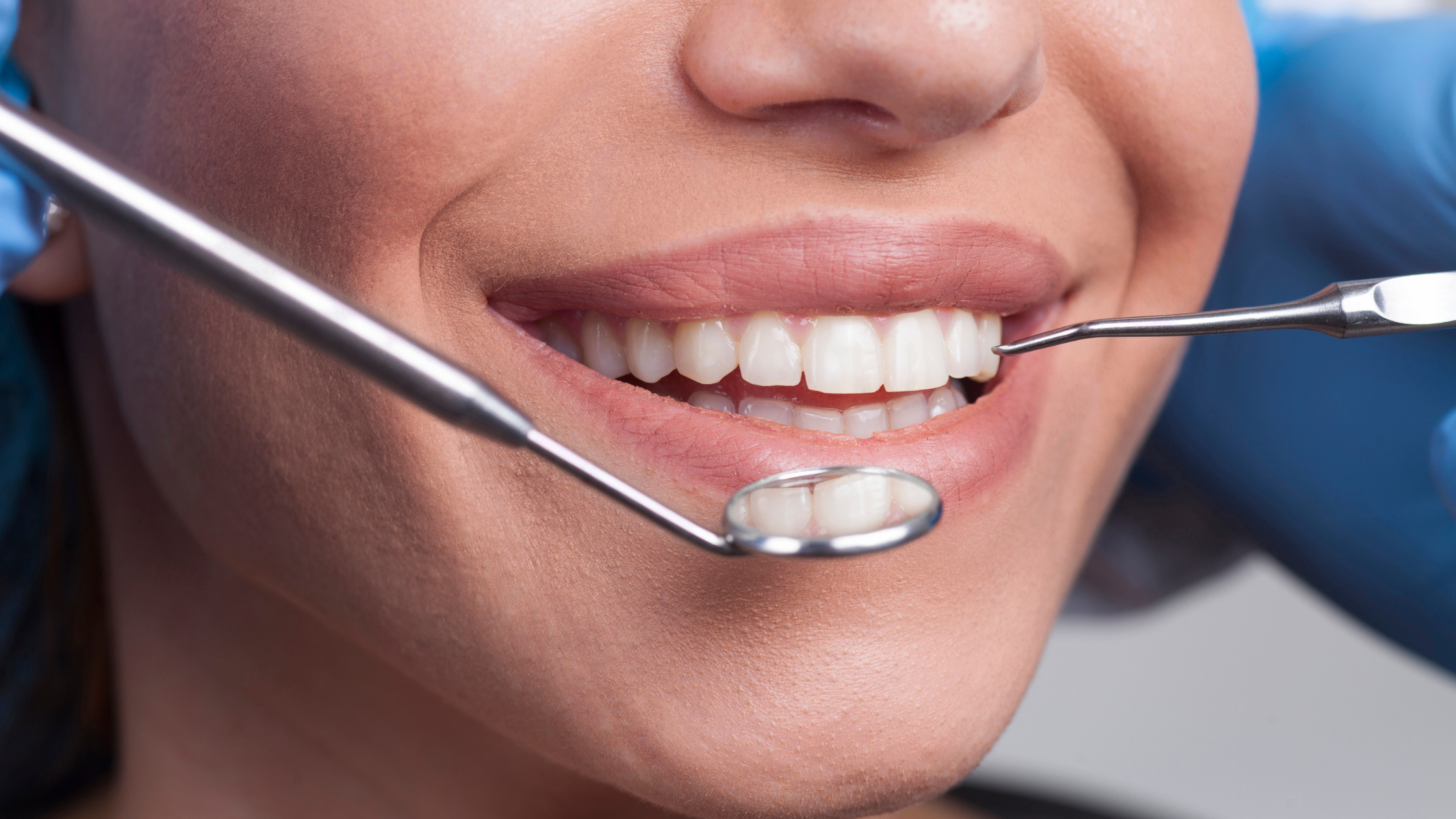 Close-up of a patient smiling during a dental exam with mirror and scaler tools
